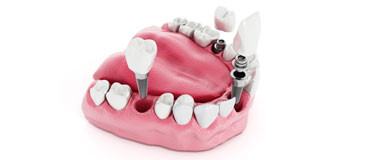  Successful Cases Of Dental Products